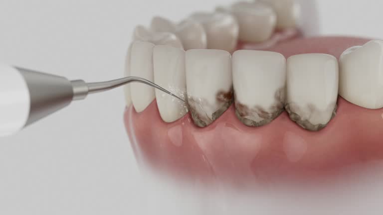 Trusted Teeth Cleaning And Checkup service in Jasper, FL - Dentist Open Now